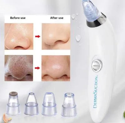 Dead Skin Remover Black Head