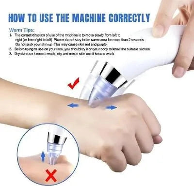 Dead Skin Remover Black Head