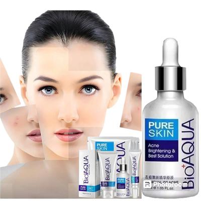 3 in 1 Anti Acne Skincare Bundle