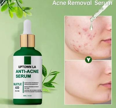 Anti-Acne Face Serum